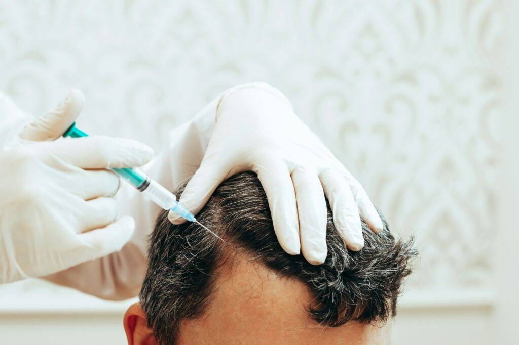 Cosmetologist performs anti-aging procedures injections acid into scalp, hair growth prevention